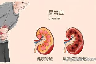 电讯报：若塔和琼斯均无法参加周末同切尔西的联赛杯决赛